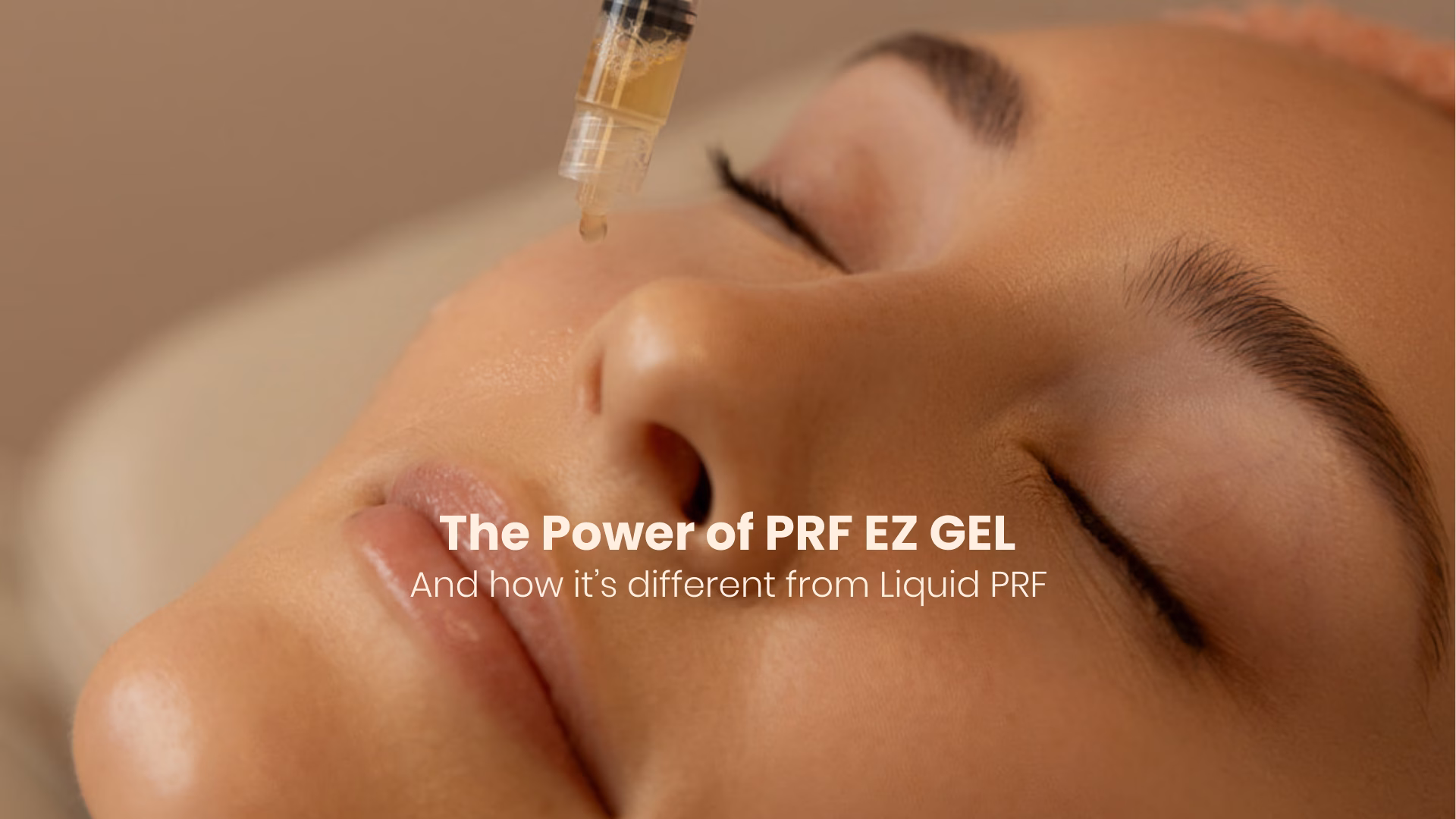 prf ez gel