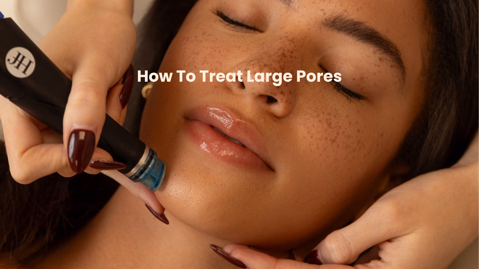 how to treat large pores