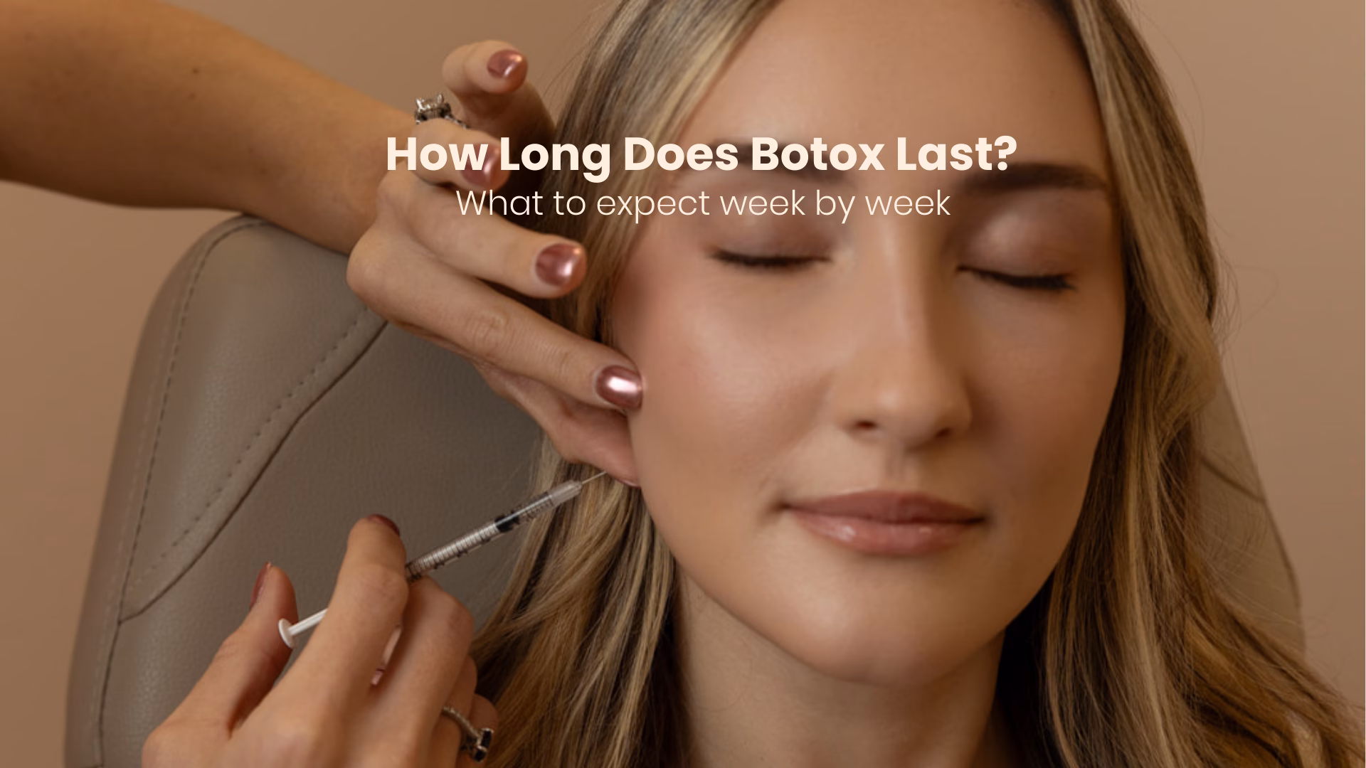 how long does botox last