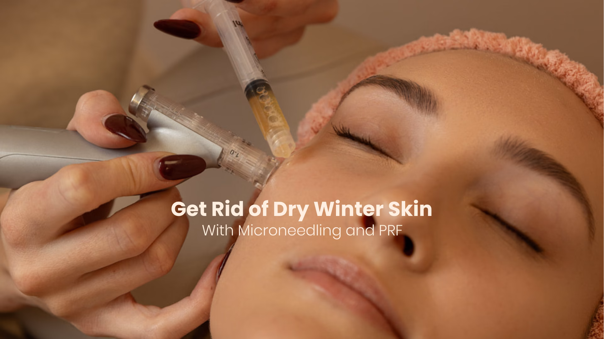 best microneedling with prf