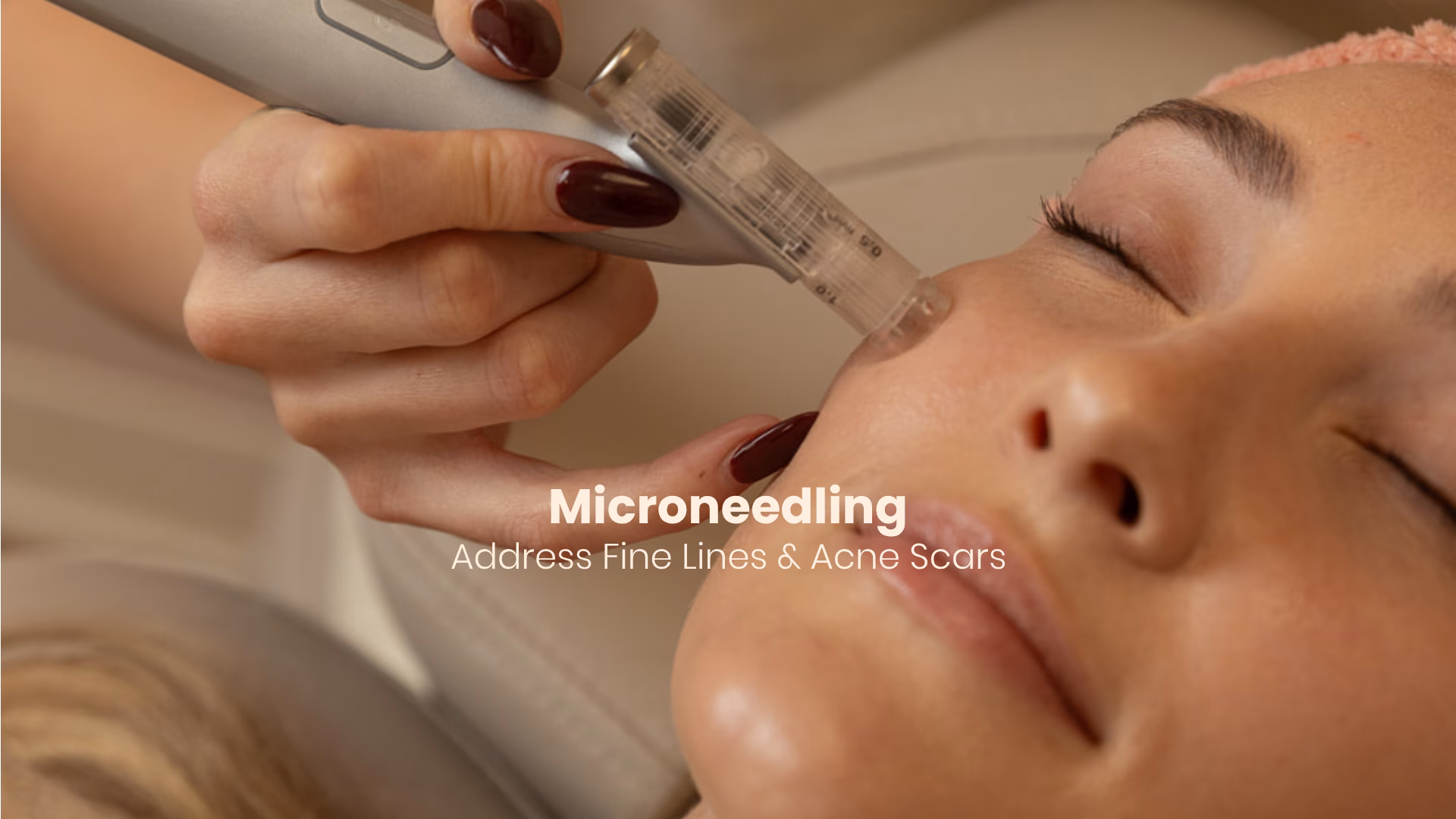 microneedling decatur